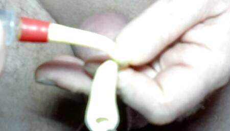 18Fr Catheter insertion