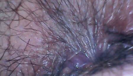 Hairy ass exploration with endoscope and farts 4K avi