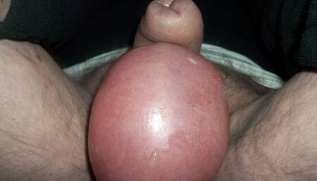 Papylouna Saline injection in the balls