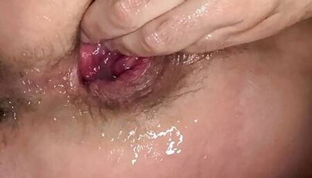 Asshole steak