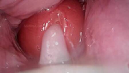 Camera in Vagina, Cervix POV, "Creampie"