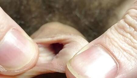 A very close look at my veiny white foreskin