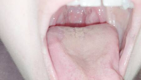My bright red uvula mov