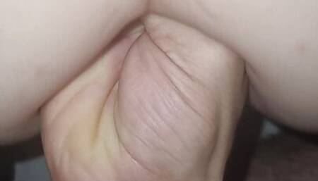 Anal fisting