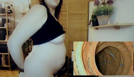 Endoscope Trip In My Ass Farts & Anal Orgasm With Contractions - Extreme Medical Vore 760HD