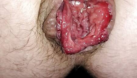 Fisting my pighole rosebud
