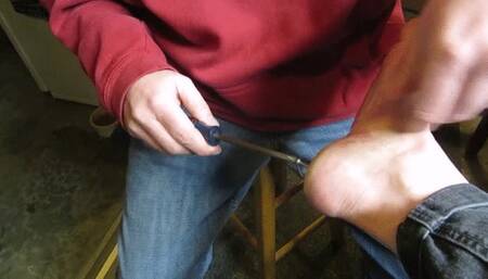 Two screws in Donna's right heel!  Oh my!