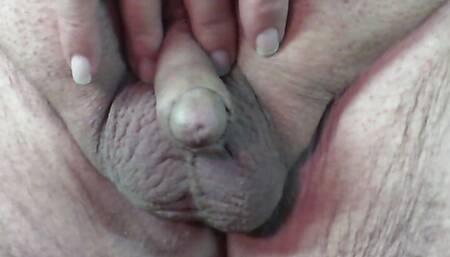 Charlie or Charles Johnson teeth, clit-like penis size, spread ass cheeks, asshole close up