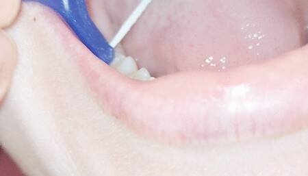 Flossing and Burping