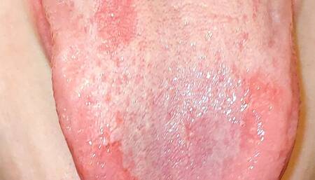 Showing off my uvula and tongue wmv