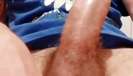 My foreskin