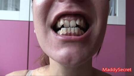 Sexy teeth [MADDALENA],