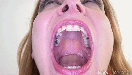 Inside My Mouth - Radka got mouth exam (MOBILE)