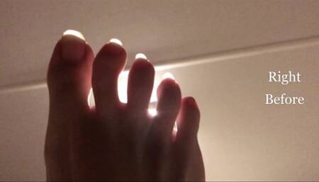 Jan 17 '23 Extremely Long Toenail Update HD