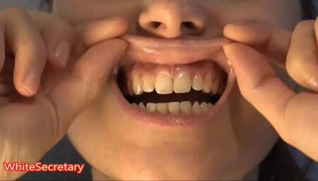 Sexy teeth [JESSICA],