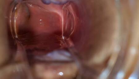 BBW Extreme Anal and Asshole Speculum Gape