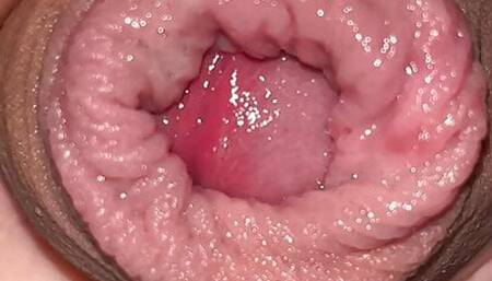 Wet foreskin close up.