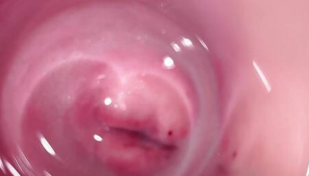 Camera deep inside Mia's creamy pussy, teen Cervix close up