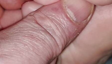 Caro's foot