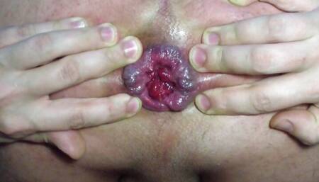 Gape. Opening my ass, trying to show my rectum.