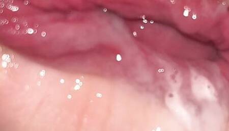 wet foreskin play close up with cumshot inside foreskin.