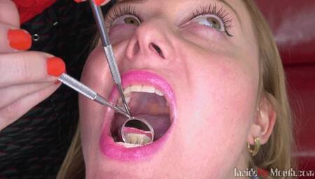 Inside My Mouth - Lola has a dental check-up (4K)