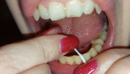 dental floss - part 8