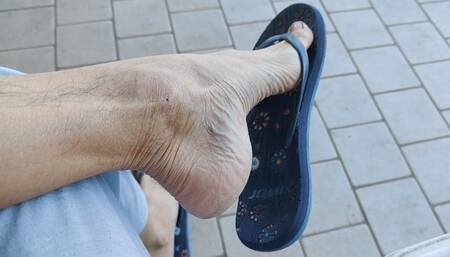 Dangling, shoeplay and flip flops slapping on my soles