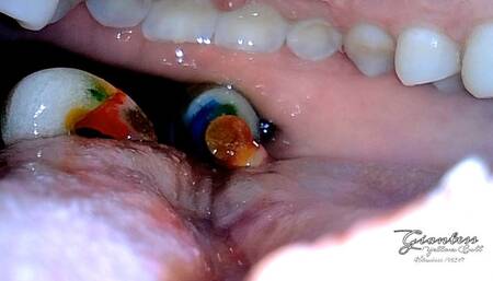 Lollipop inside mouth view