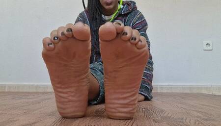 Nut on my wrinkled soles