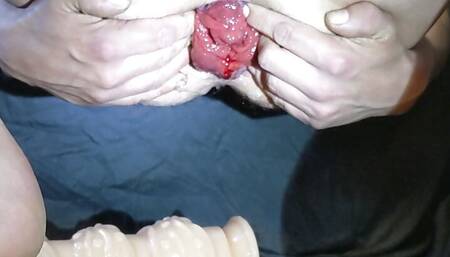 Huge fisting toy and prolapse