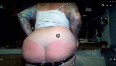 Check My Body For Sunburn!