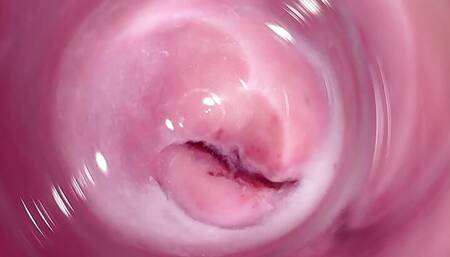 Camera deep inside Mia's teen creamy pussy, Internal camera