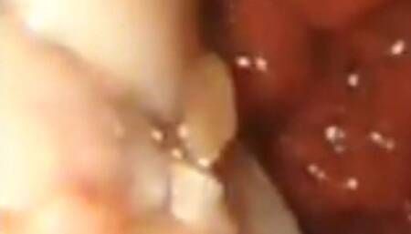 Whole chicken digestion endoscopy 1080HD