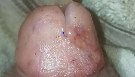 Inflated Bladder