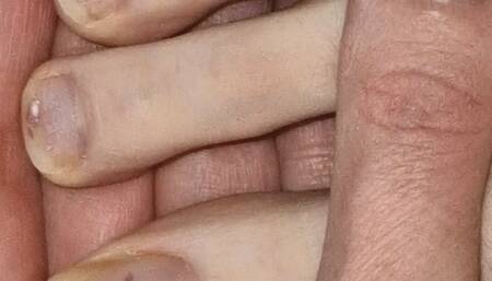 very unkempt nails, be shine