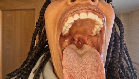 My UVULA mushrooms and cutter