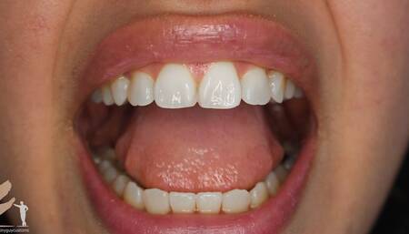 Chia Eating Mouth Vore Close Ups