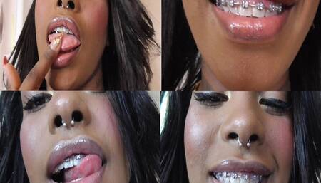 Ebony Teeth Brace Fetish! mp4