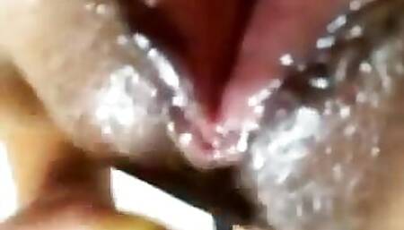 parte 3