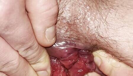 My Lower Lips