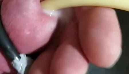 Electrocum around 22 Fr Catheter
