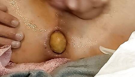 anal dilate