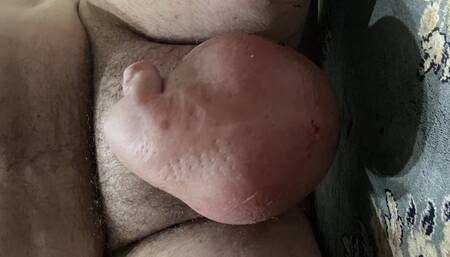 Saline Balls Fun