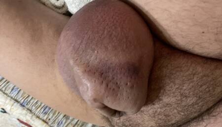 Saline Balls Wangling
