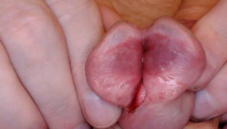 Jacking off and Gaping my split glans