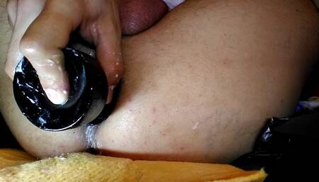 Anal dilatation 02