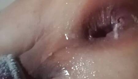 Culo vicioso