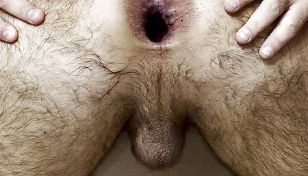 Bottle in my ass and huge gaping hole! Look in my asshole