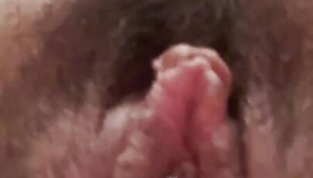 Urethral pussy stapler